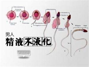 【兰州陇大医院】精液不液化是怎么回事?